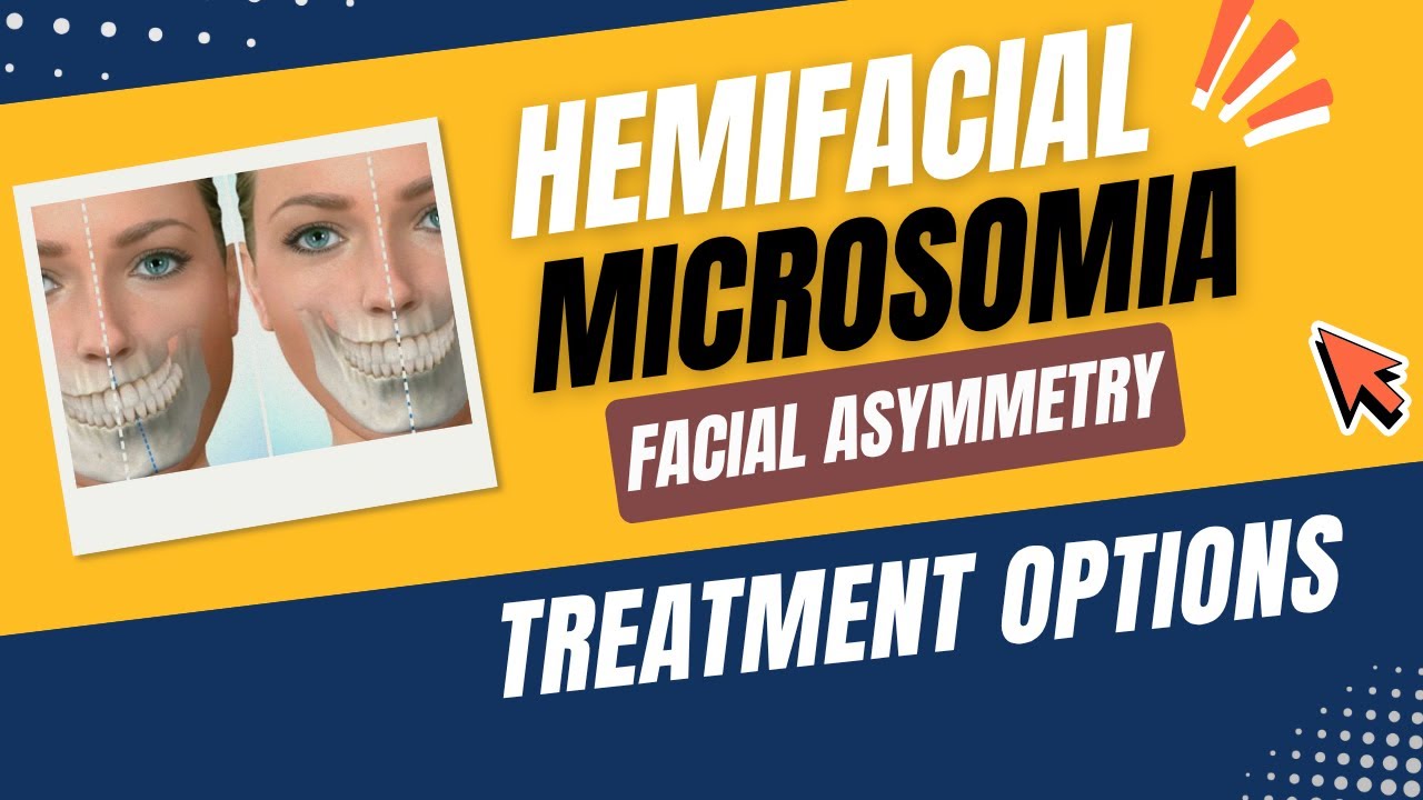 Expert Reveals SHOCKING Truth About Hemifacial Microsomia Facial Asymmetry Treatment | Dr. PK Talwar