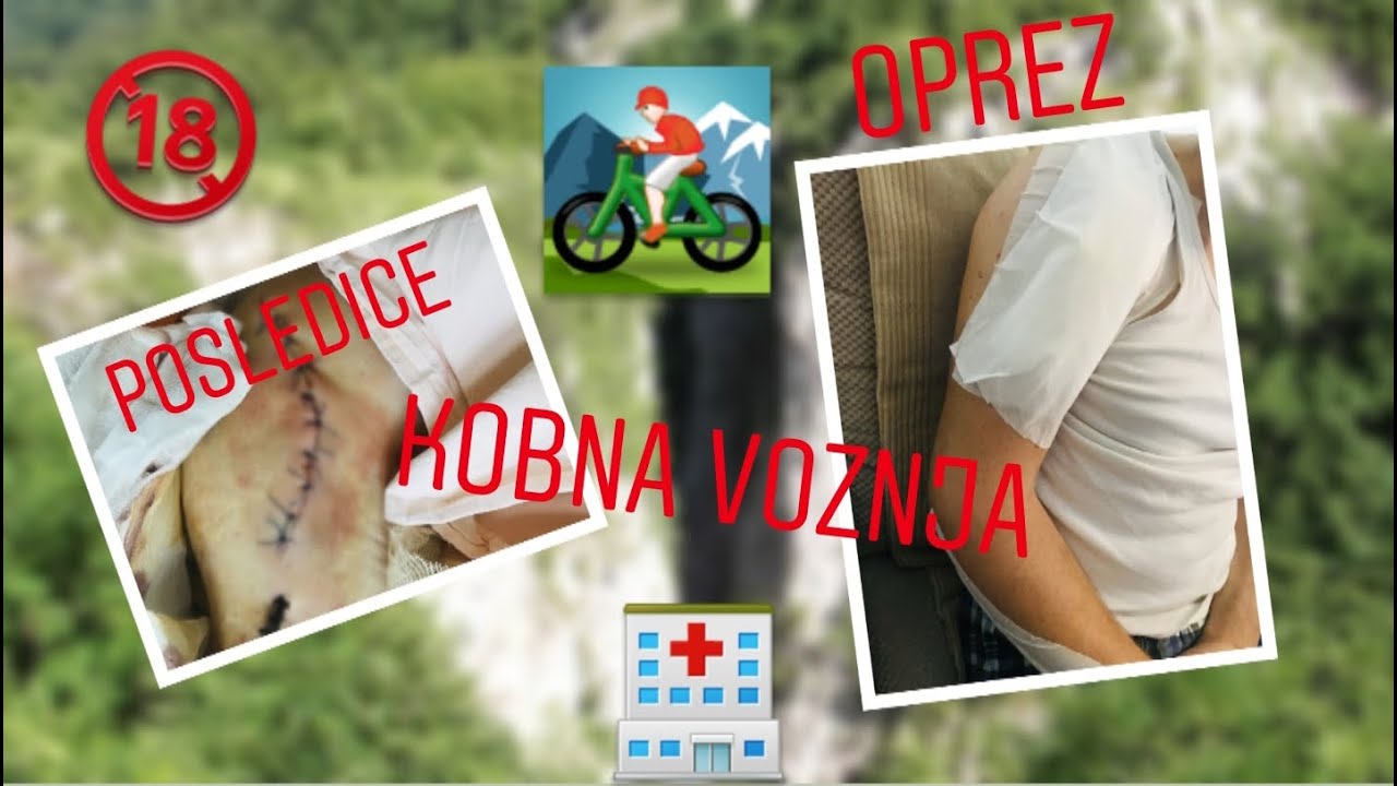 Pad sa teškim posledicama