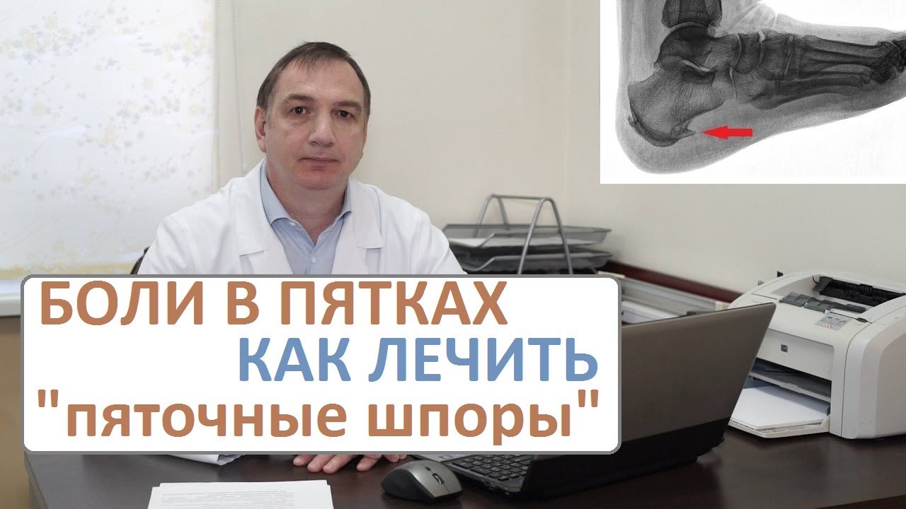 Боли в пятках, лечение. Пяточные шпоры - как их лечить.