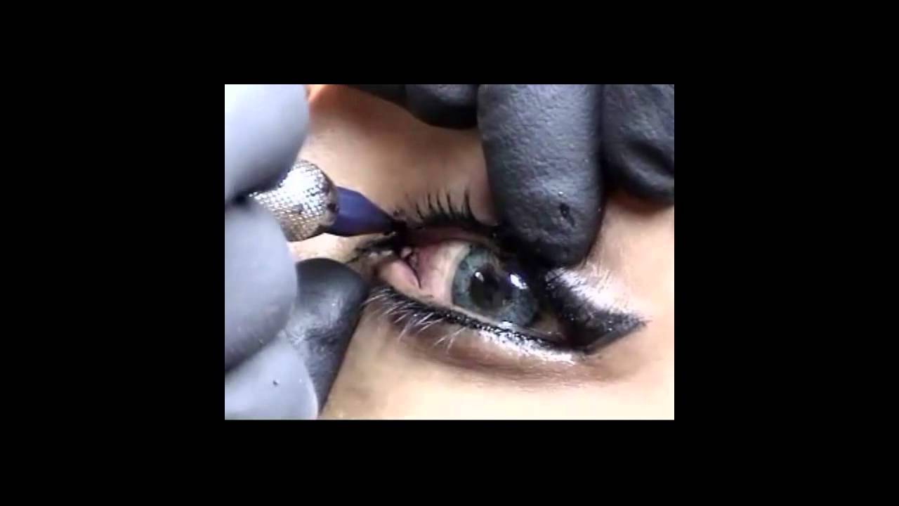 MICROPIGMENTACION EN OJOS