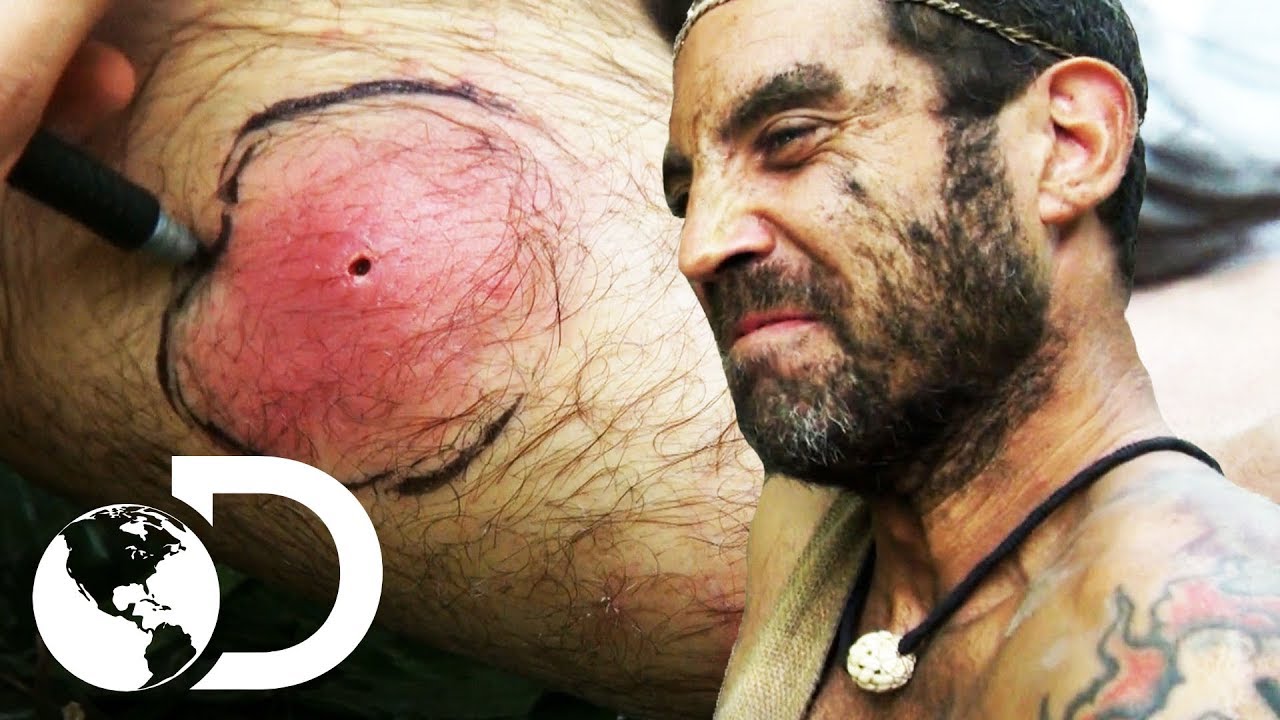 Homem sobrevive a carrapatos e aranhas venenosas | Largados e Pelados | Discovery Brasil