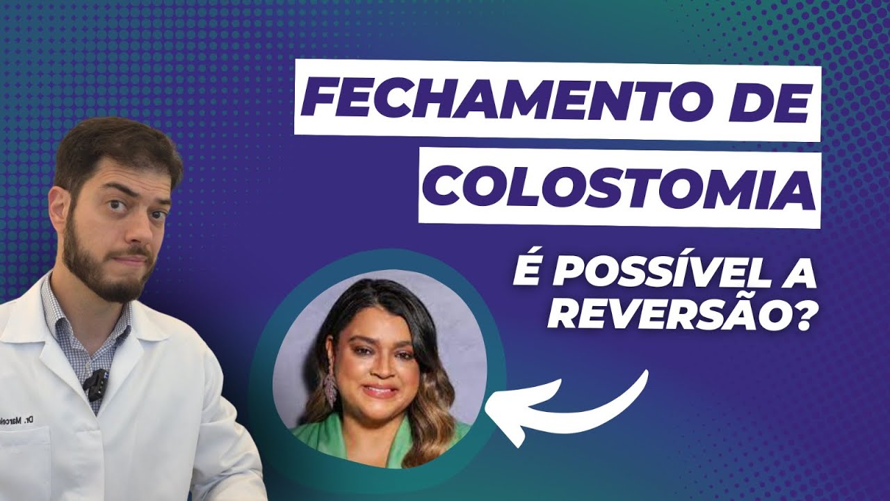 Fechamento de colostomia, é possível a reversão?