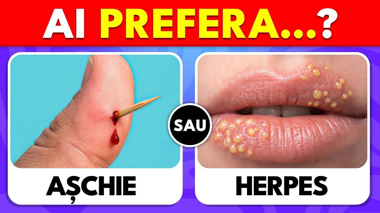 AI PREFERA…? Ediția EXTREMĂ! ⚠️😱 Cele mai grele alegeri! | Beaver Quiz - RO