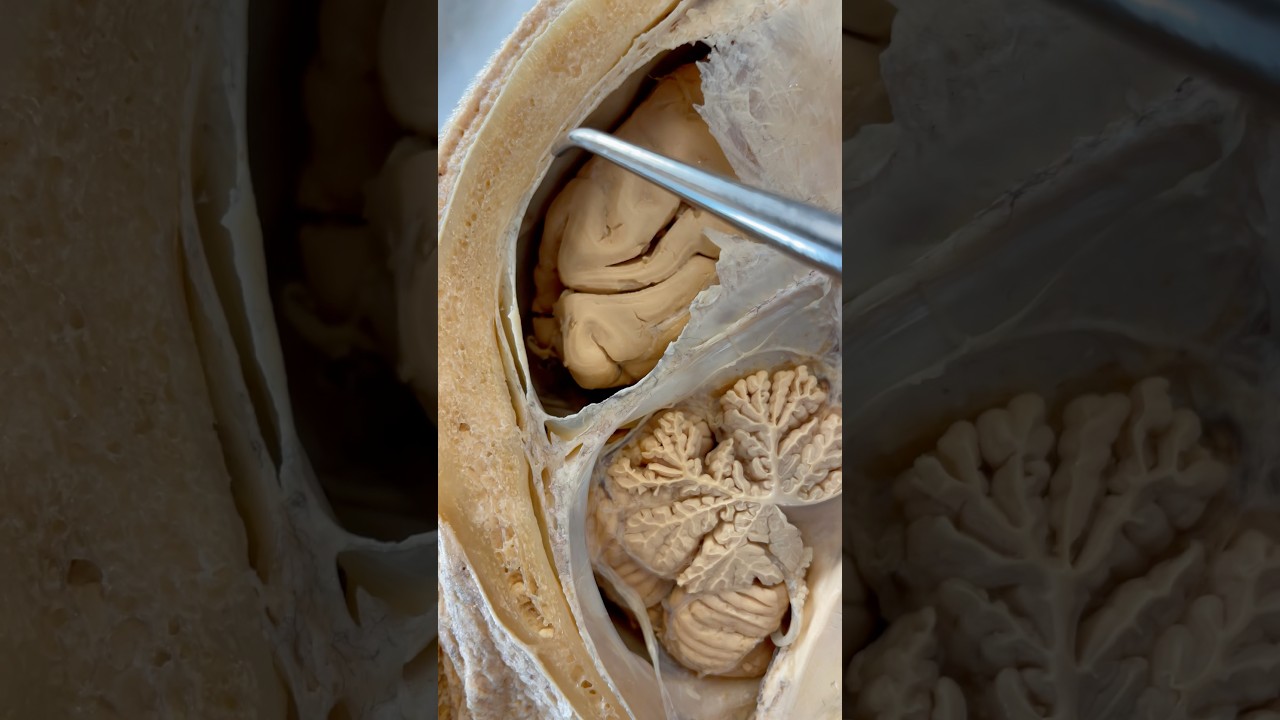 Incredible Tissue Surrounding Your Brain | Institute of Human Anatomy