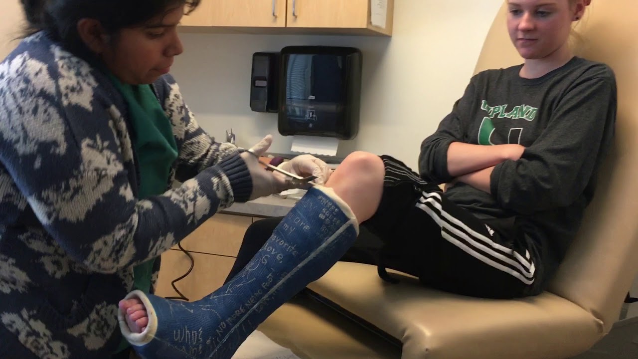 Getting my foot cast off after a major reconstructive surgery !