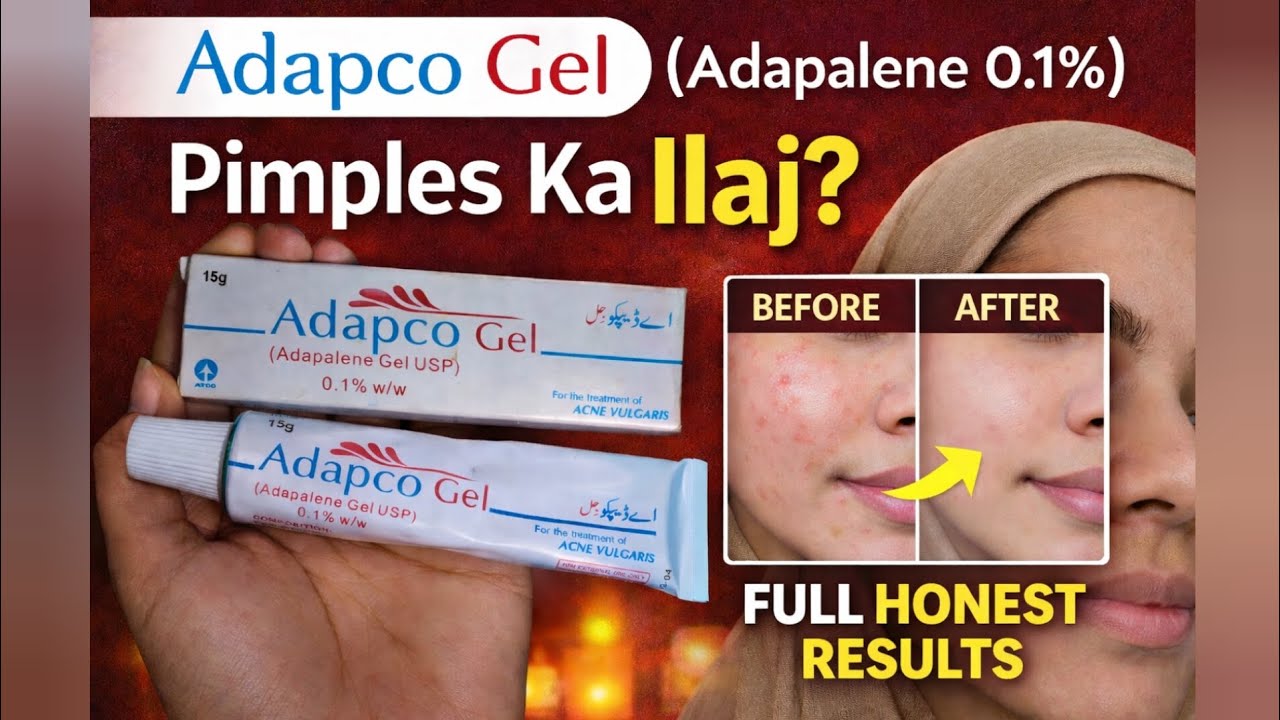Adapco Gel Review | Adapalene 0.1% Se Pimples Ka Asli Ilaj? Full Honest Results