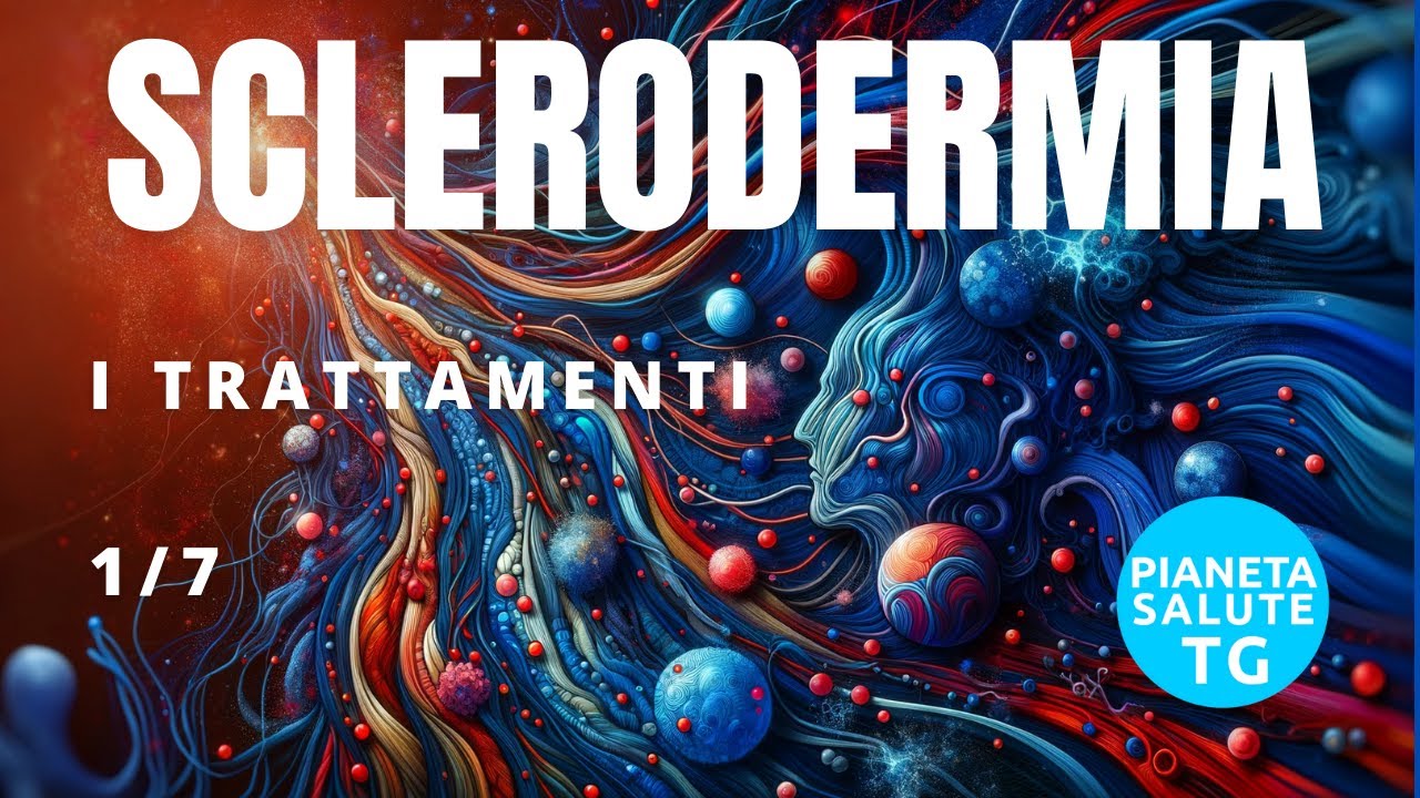 Sclerodermia: guida completa ai trattamenti per affrontare la malattia