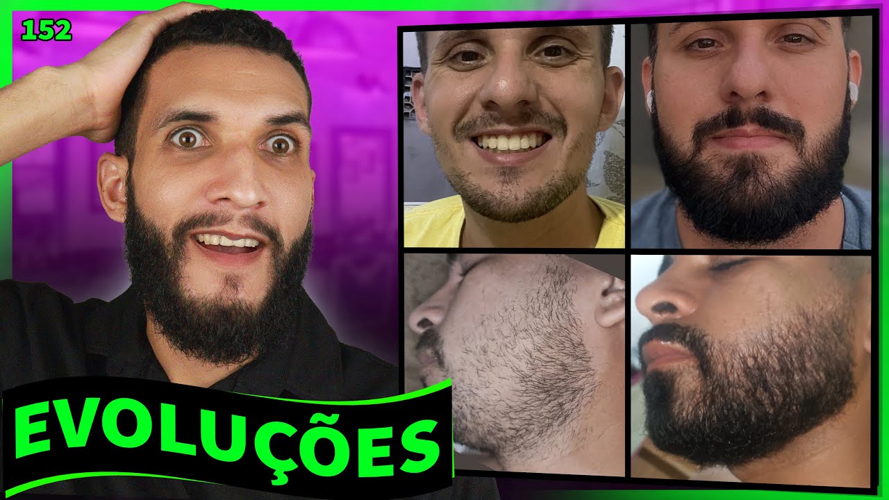 EVOLUÇÕES  COM MINOXIDIL (resultados dos inscritos) #152