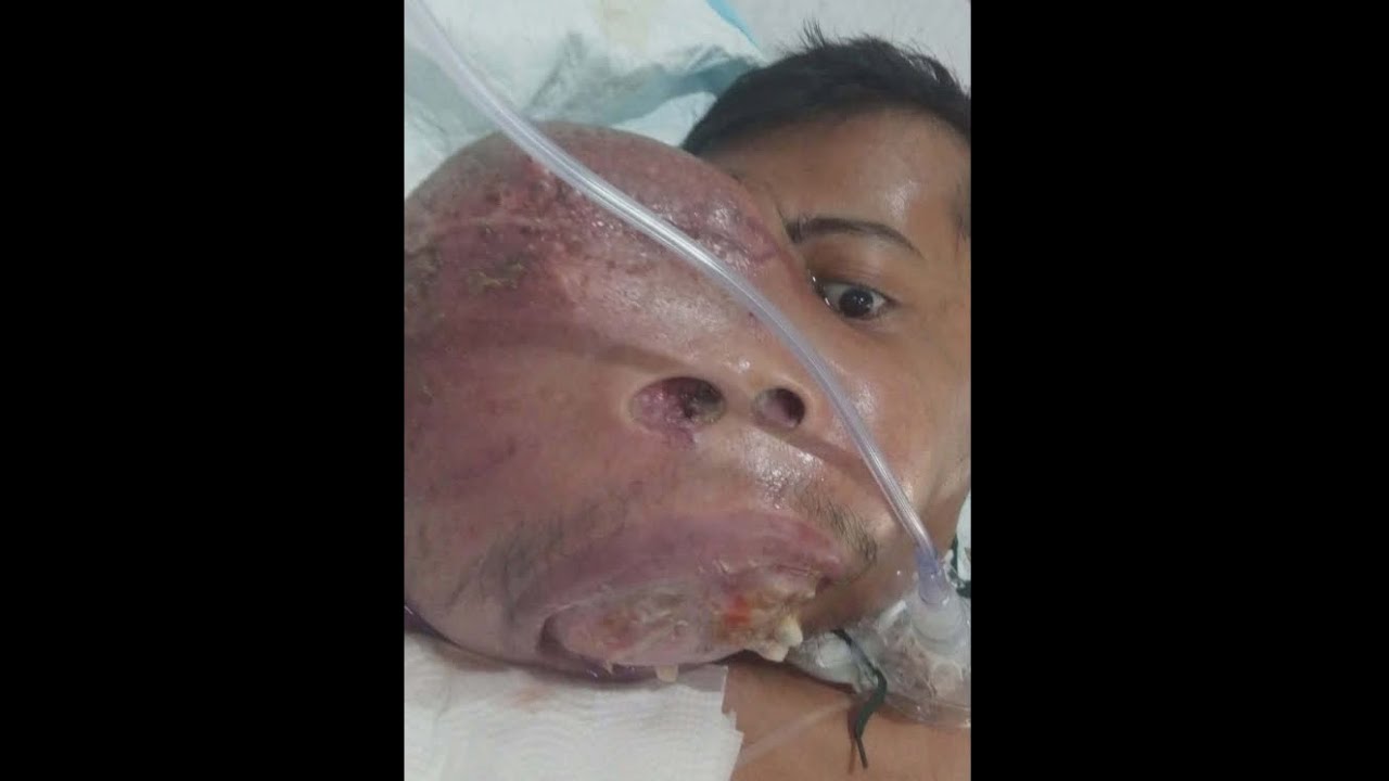 Не очень хорошие новости для операции Сонни Боя.