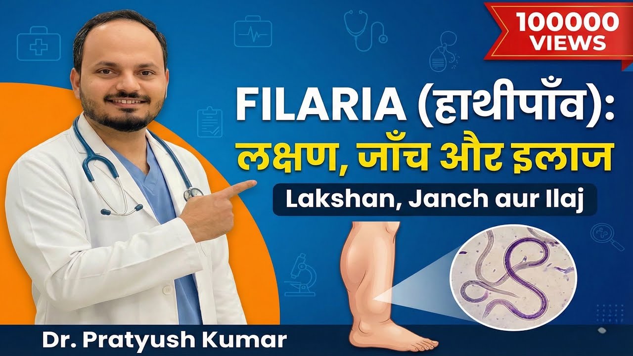 Filaria : फाइलेरिया के कारण, लक्षण और इलाज | Dr. Pratyush Kumar | Physician | Filaria specialist