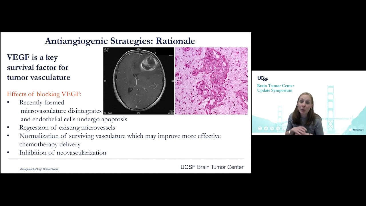 Current Management of High-Grade Gliomas - Nancy Ann Oberheim Bush, MD, PhD
