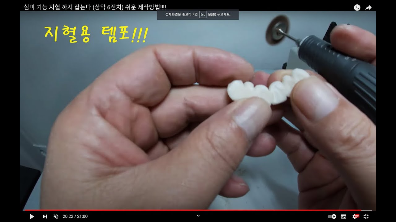 심미 기능 지혈 까지 잡는다 (상악 6전치) 쉬운 제작방법!!!!