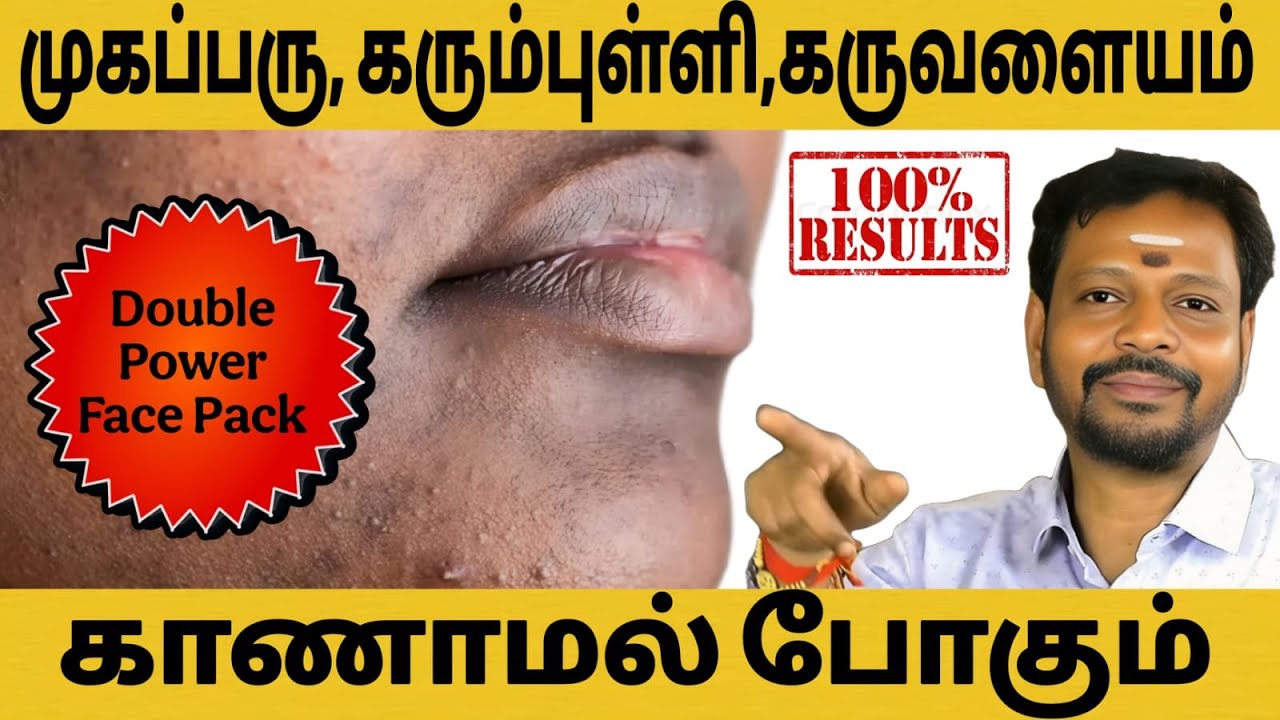 முகப்பரு,கரும்புள்ளி,கருவளையம் நீங்க | முக அழகு அதிகரிக்க Double Power Face Pack | Tamil Beauty Tips