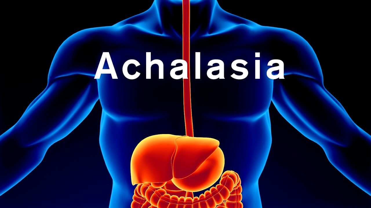 POEM procedure restores achalasia patient’s ability to swallow