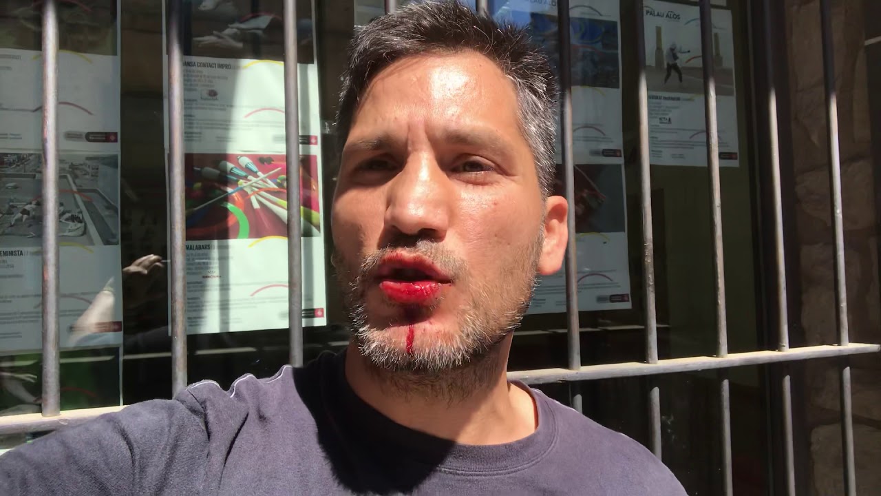 Me agreden por defender derechos