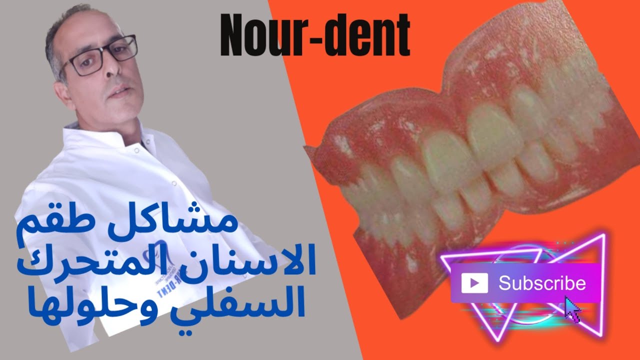 مشاكل طقم الاسنان المتحرك للفك السفلي وحلولها نهائيا.@NoureddineVlogsBr