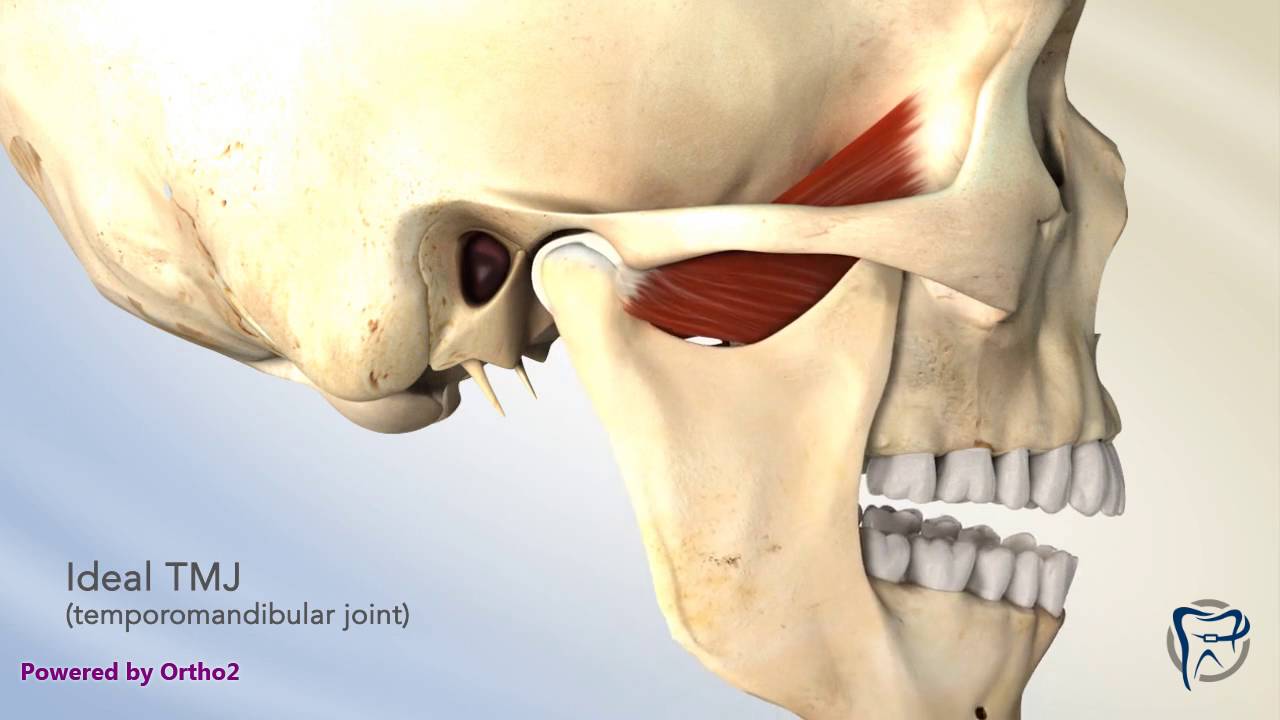 TMJ Closed Lock