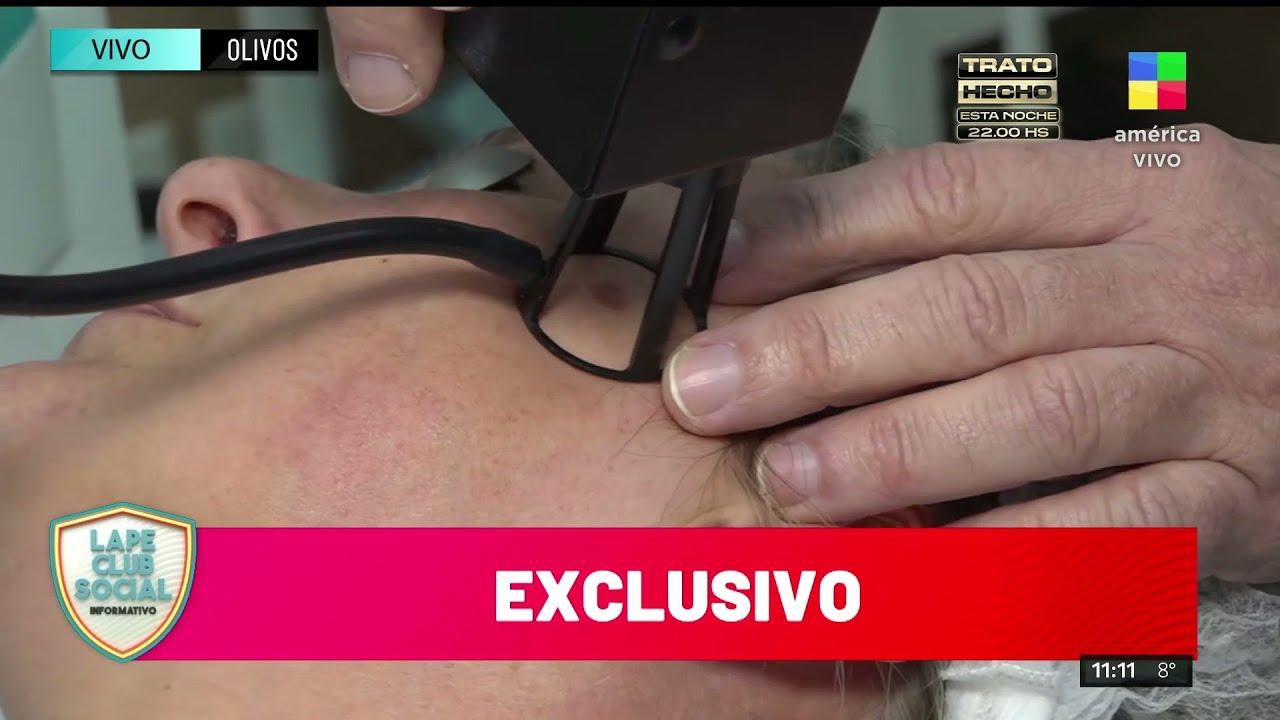🔴 EN VIVO: AS&Iacute; SE HACE EL TRATAMIENTO L&Aacute;SER QUE ELIGI&Oacute; ELIANA GUERCIO