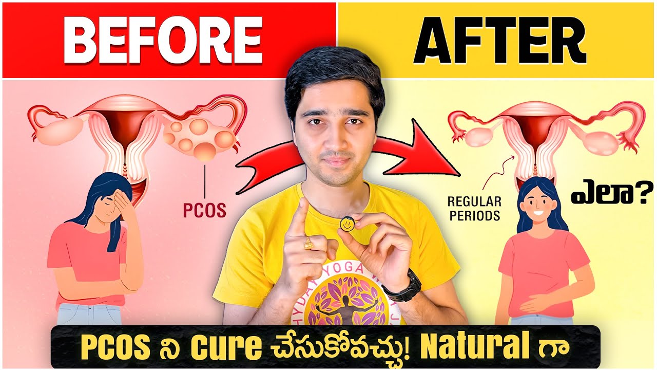 PCOS తగ్గి Periods Natural గా రావటానికి solution ఈ video లో | PCOS - Causes and Cure #pcos #periods