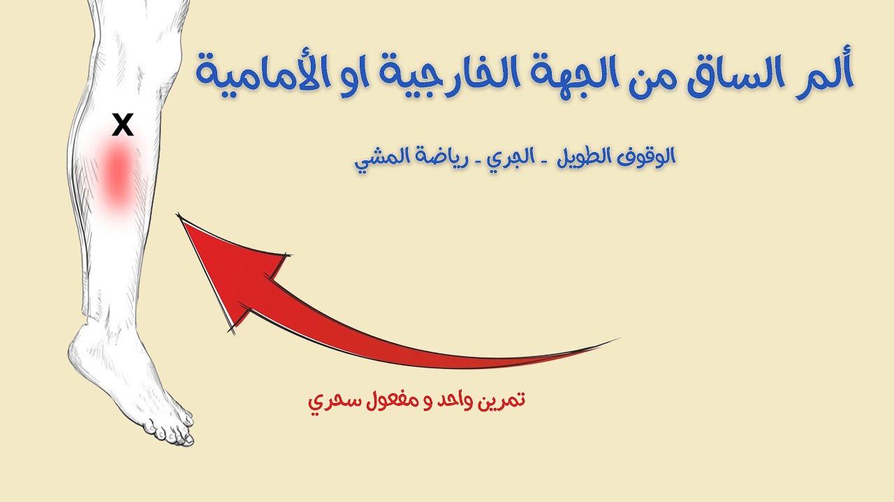 ألم الساق من الجهة الخارجية - الوقوف الطويل او الجري لمسافات طويلة او حتى القفز على الحبل