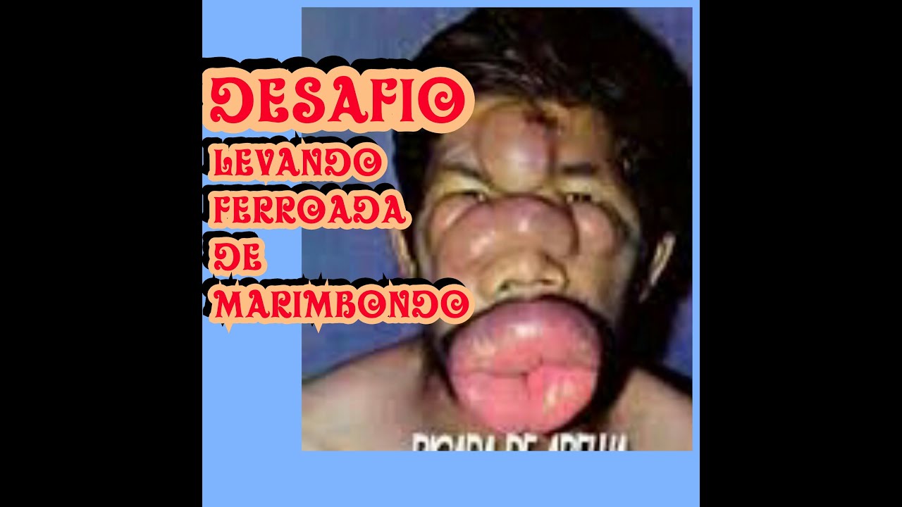 DESAFIO: LEVANDO FERROADAS DE MARIMBONDO (CHALLENGE TAKING STING MARIMBONDO)