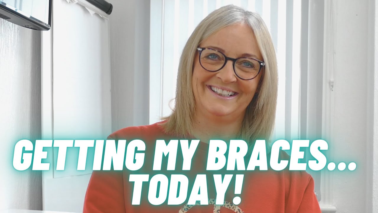 Why I chose to have braces as an adult | my six-month smile journey | ep 1