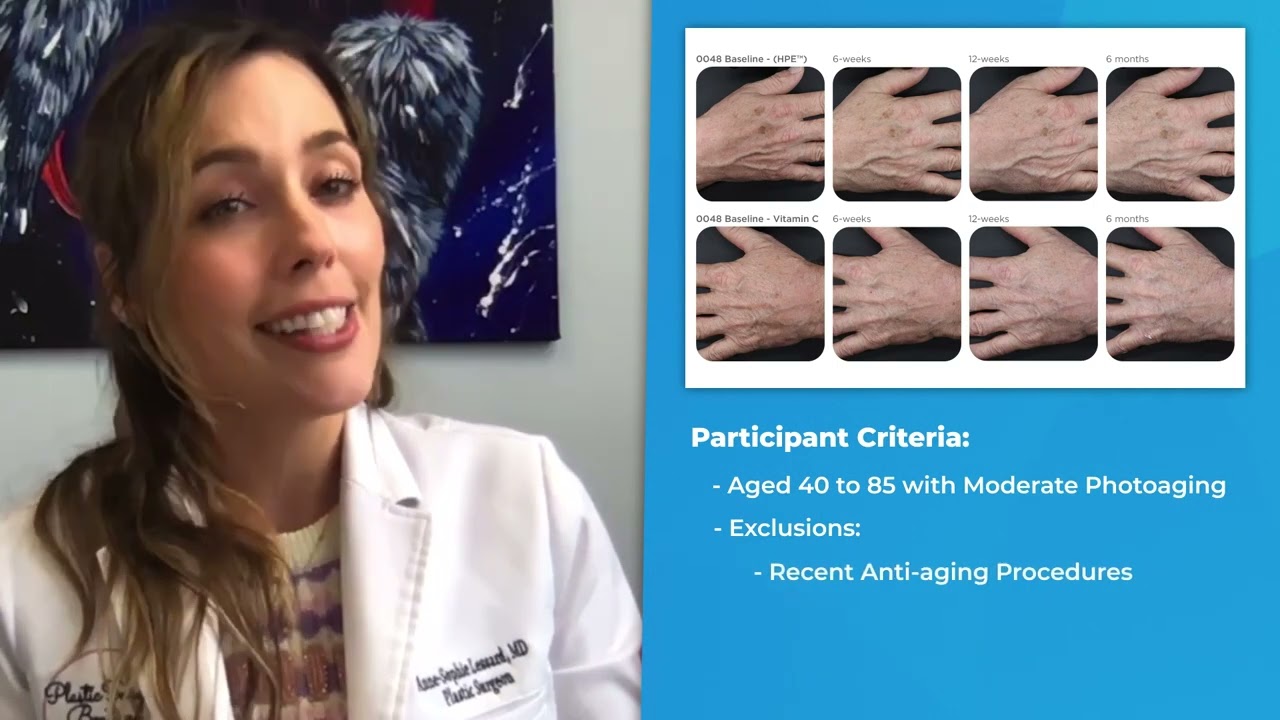 Topical Treatments for Age Spots on Hands by Anne-Sophie Lessard, MD