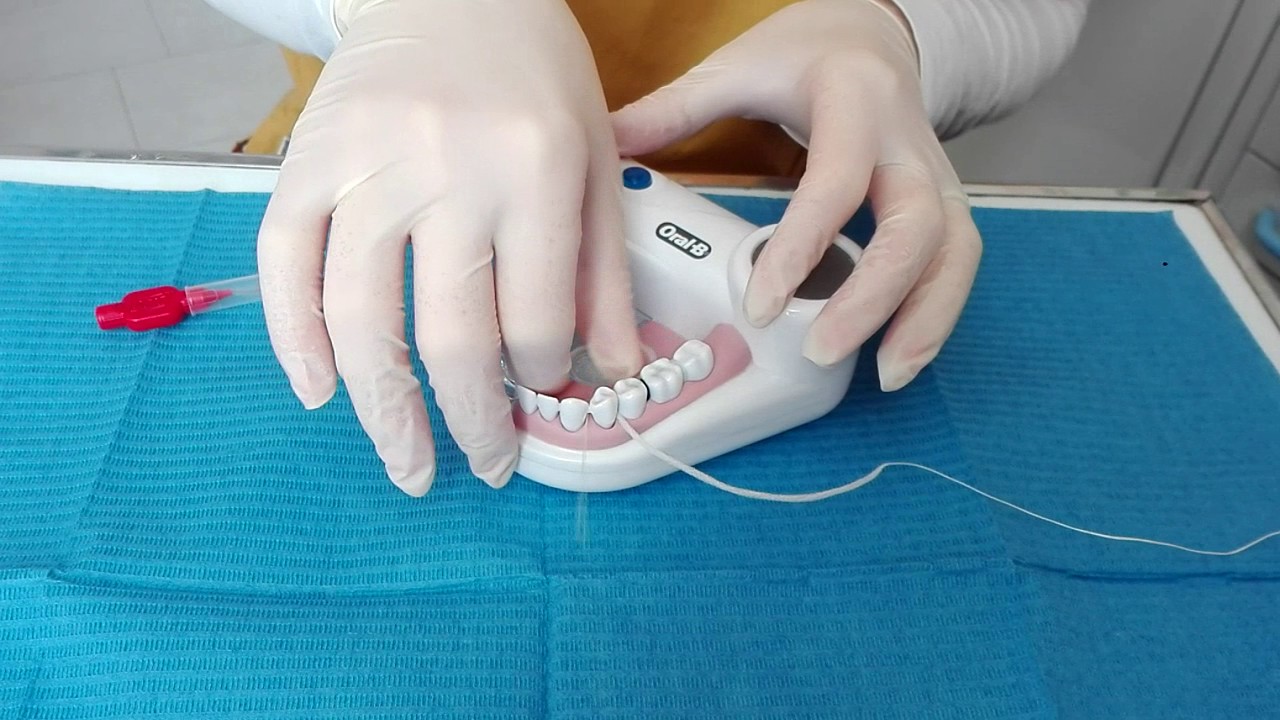 Scopri come pulire gli impianti dentali!