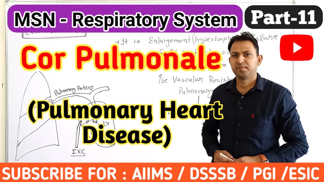 Cor pulmonale | pulmonary Heart disease - causes symptoms treatment  | respiratory msn (part-11)