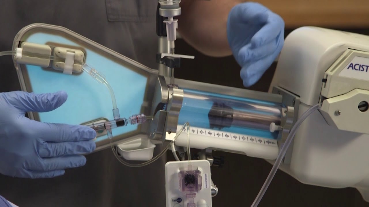 ACIST U - CVi™ Manifold Valve Open