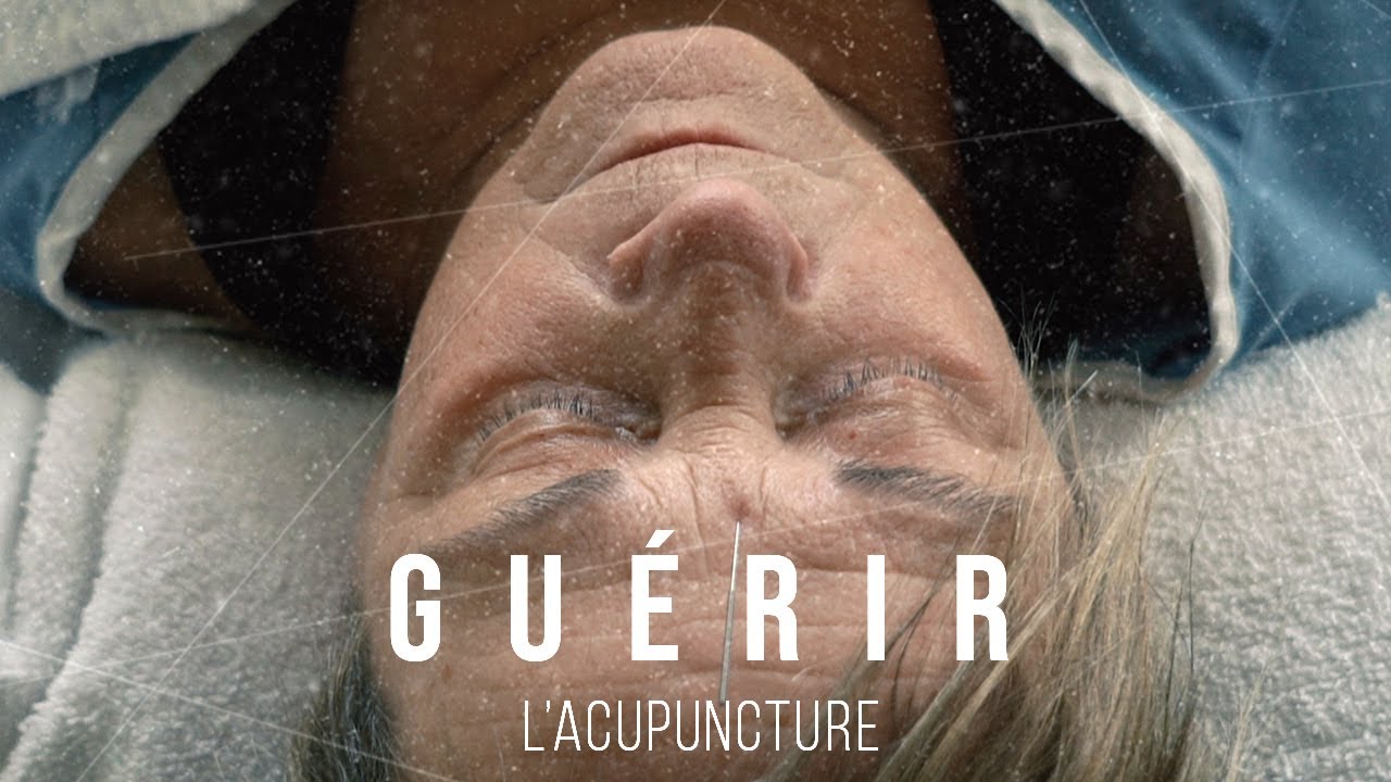 Guérir: L'acupuncture