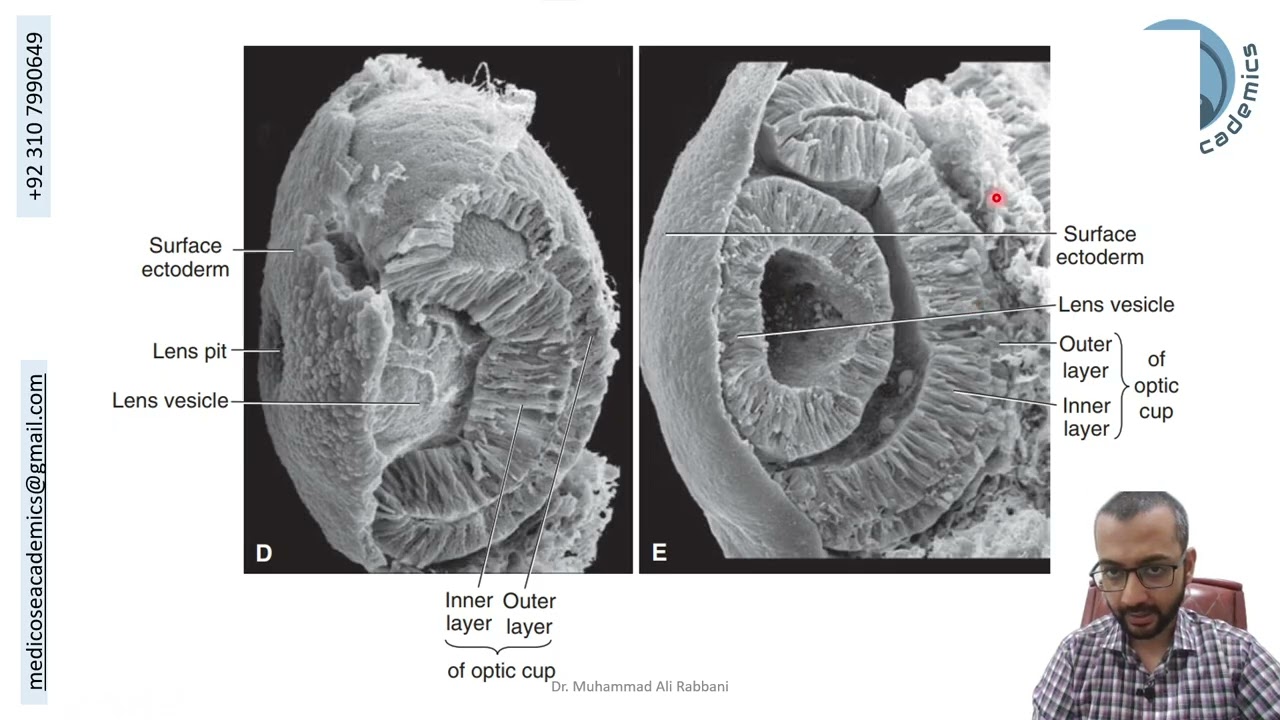 Development of Eye