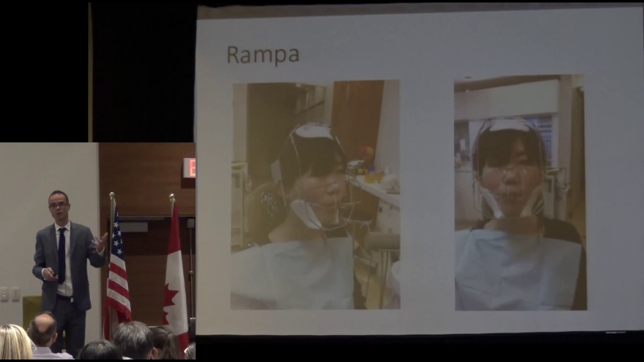 Effect of Extra-Oral Anchorage on Craniofacial Development By Dr Mike Mew. Vancouver/November 2016