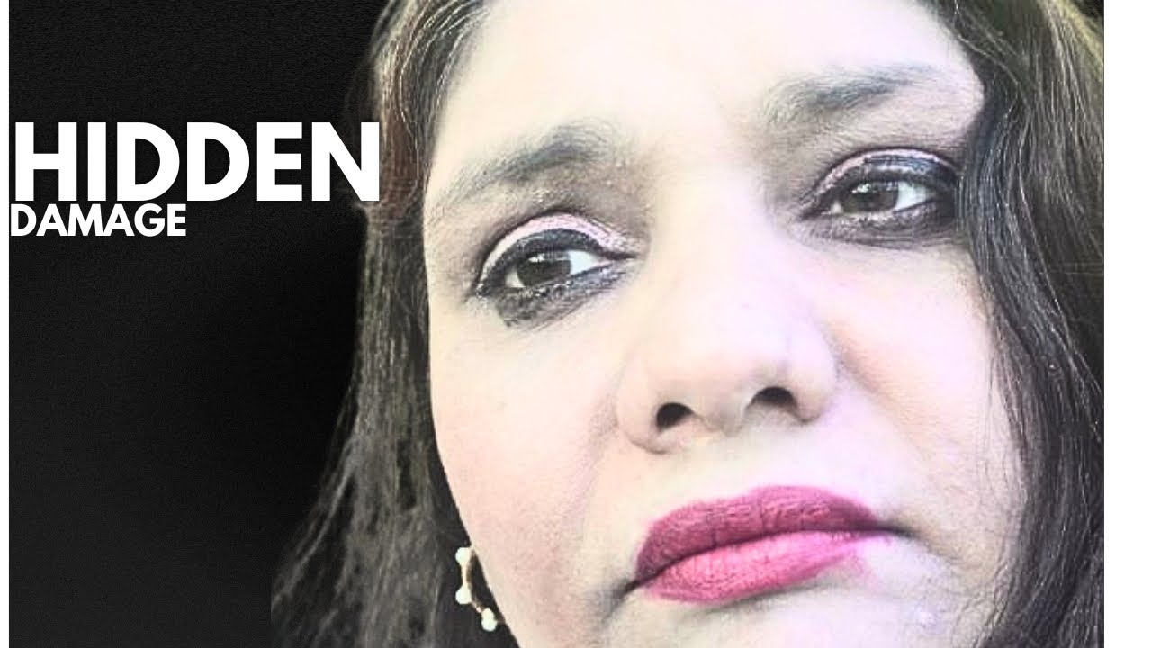 Stop This! Hidden Skin Damage from Holi & makeup