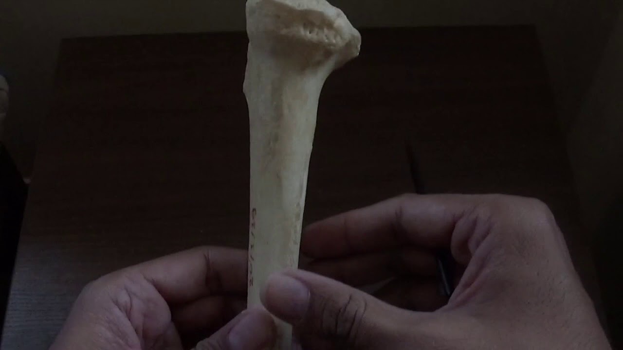 TIBIA - GENERAL FEATURES AND ATTACHMENTS