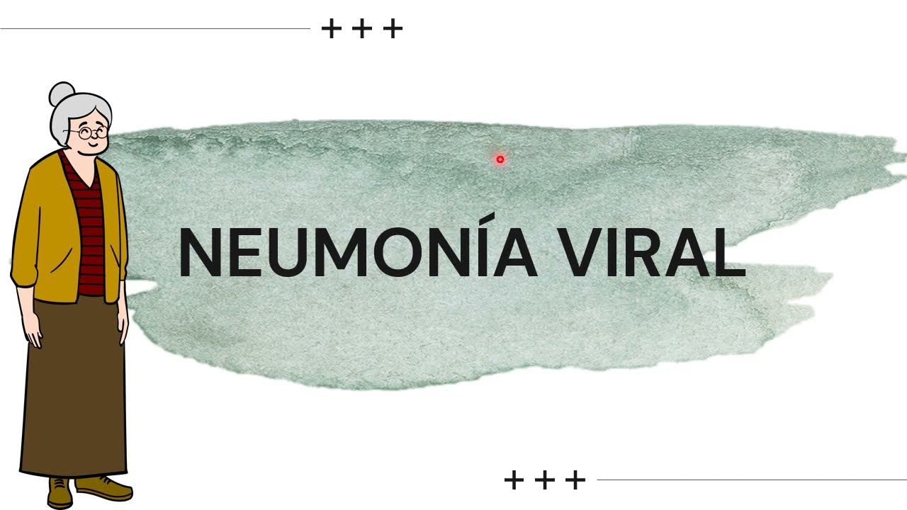 80/100 NEUMONIAS VIRALES/ INFLUENZA. ENARM