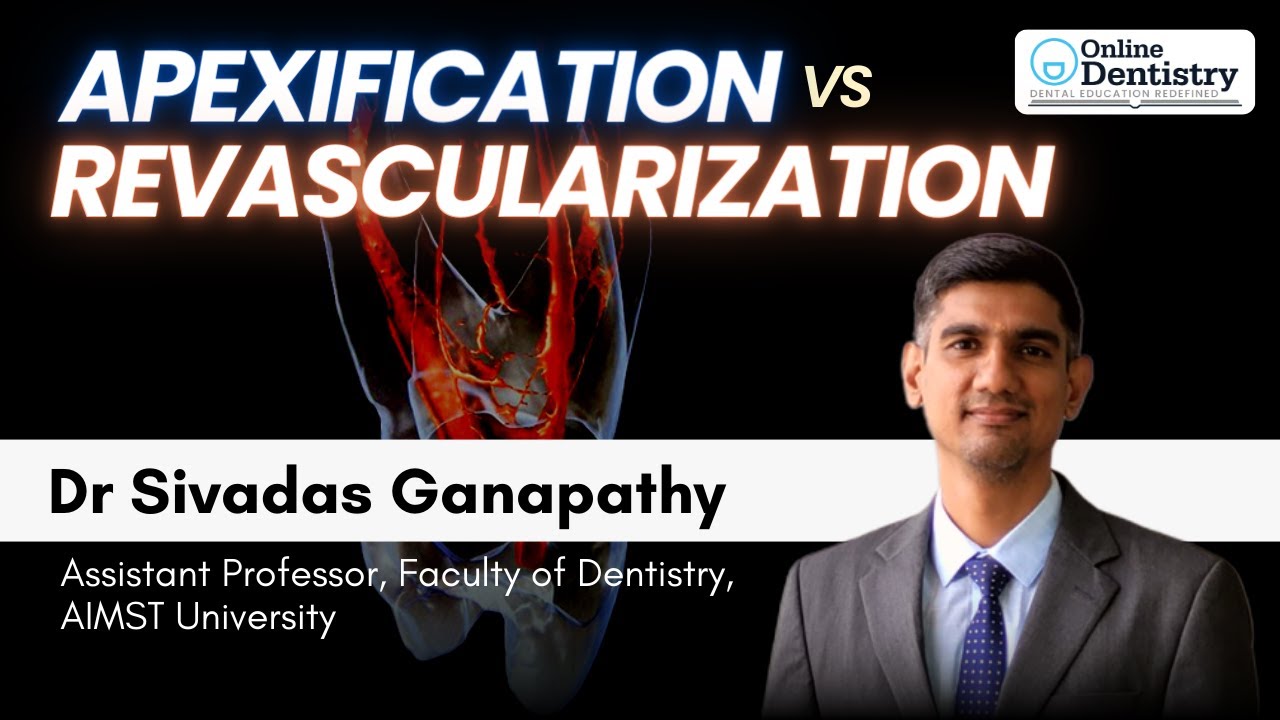 Apexification vs Revascularisation - Dr Sivadas Ganapathy | Online Dentistry @ 9 PM