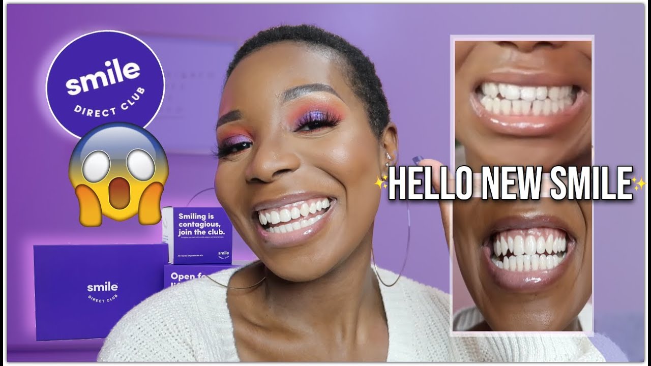 ✨SMILE DIRECT CLUB 7 MONTH UPDATE / BEFORE & AFTER FIXING MY TEETH ... DOES IT WORK?✨