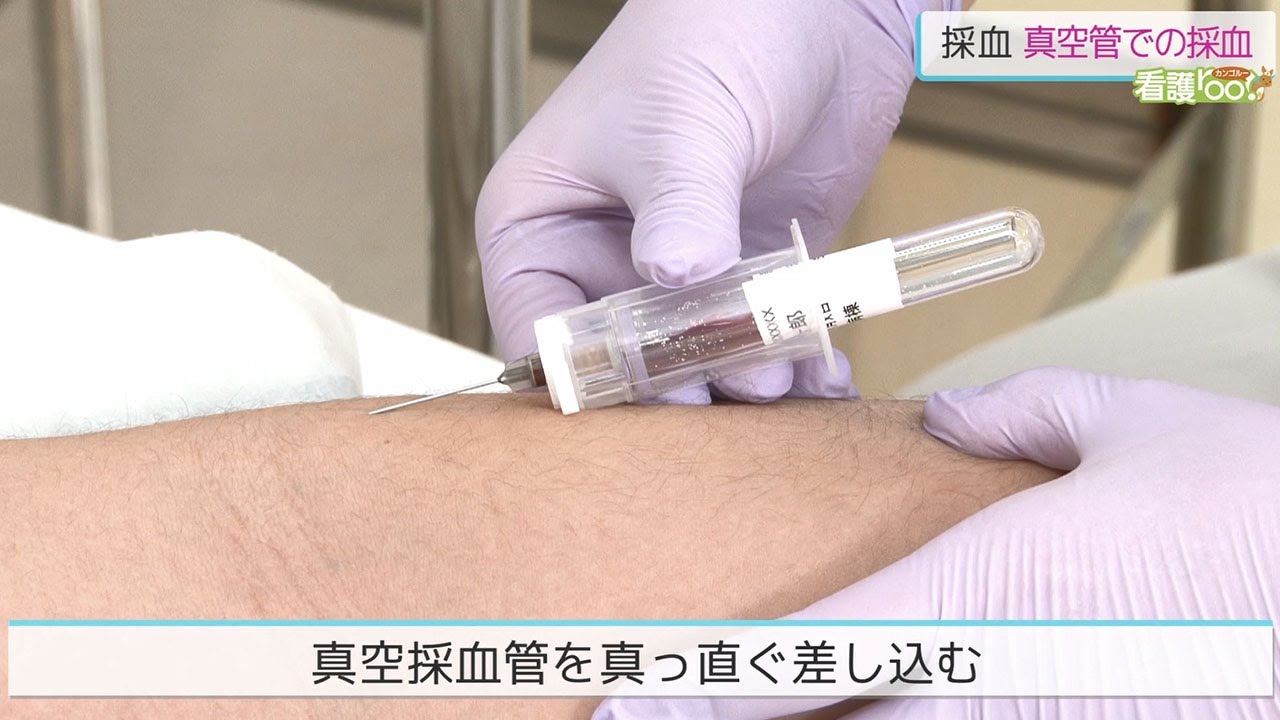 真空管での採血 ／ 監修 日本医療大学