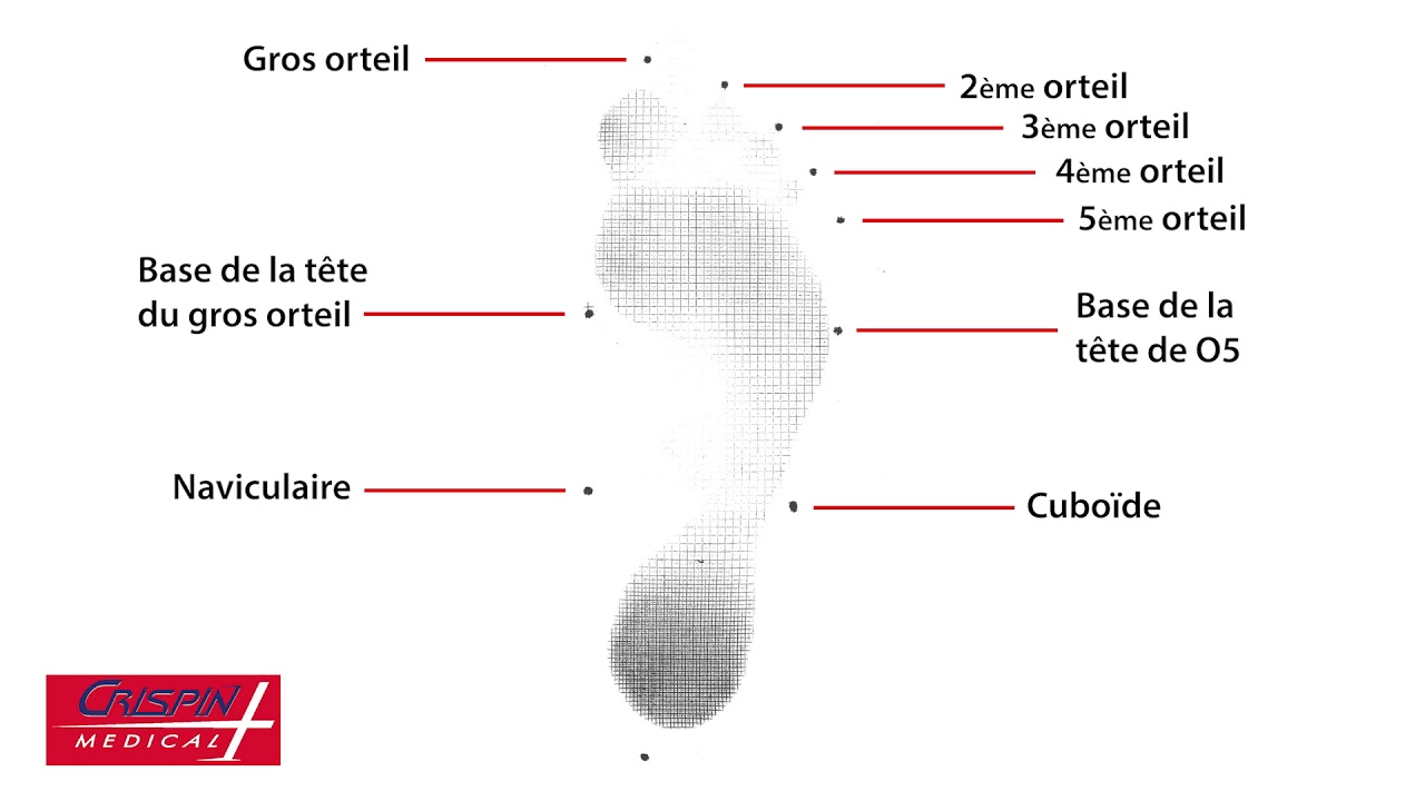 Prise d'empreinte avec podographe Crispin Médical pour la réalisation de semelles orthopédiques