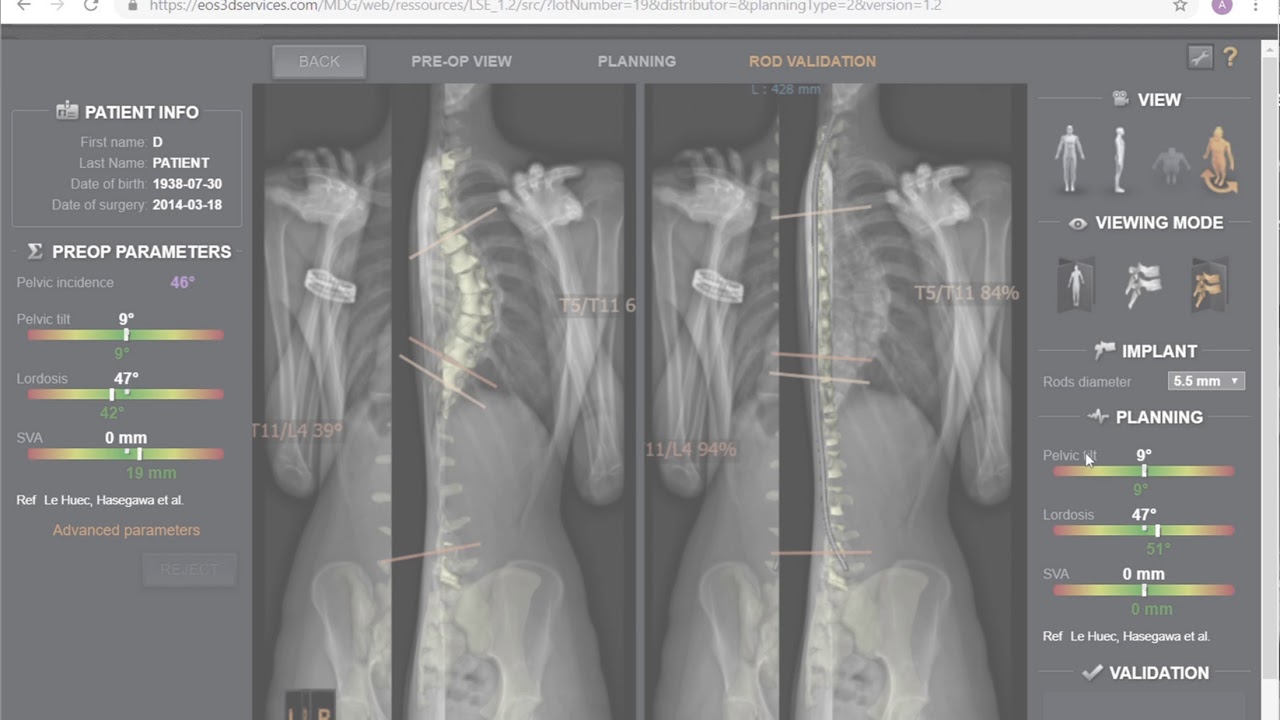 Low-dose 3D X-ray imaging