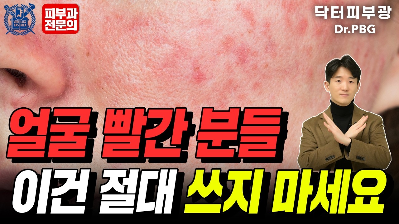 홍조, 빨간 얼굴, 주사피부염 이건 절대 쓰지 마세요 얼굴 다 망가집니다 - 피부과전문의 닥터피부광
