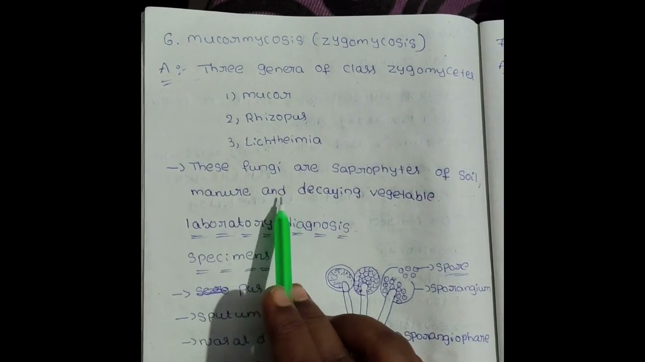 MUCORMYCOSIS Bsc Mlt 3rd year microbiology 3mark question 