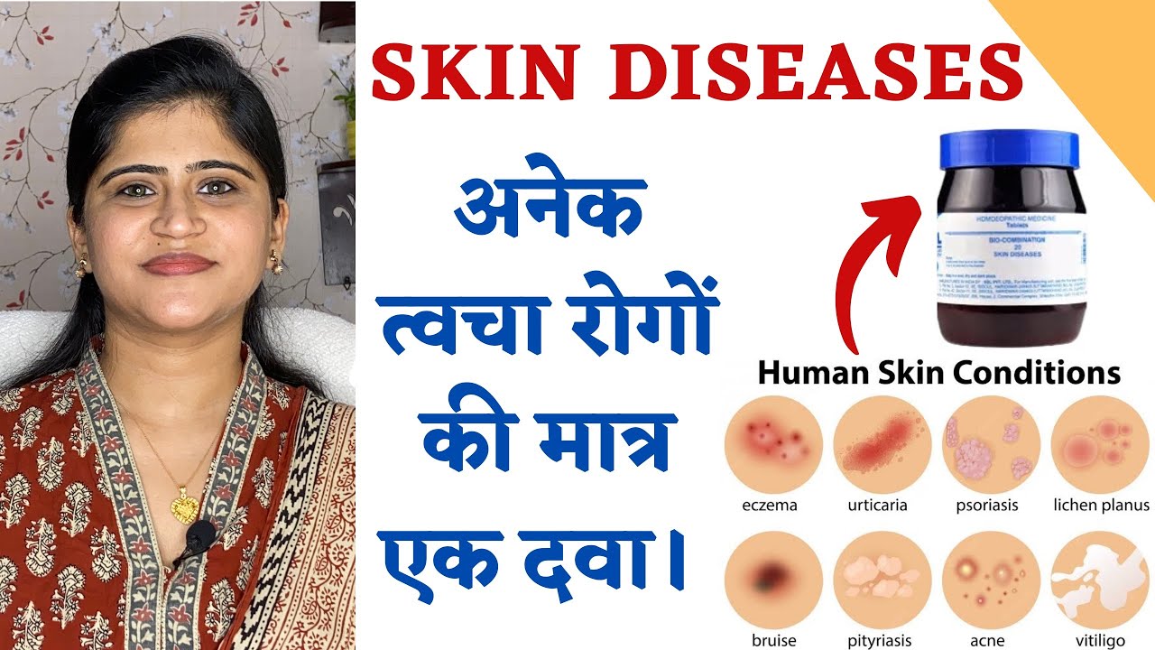 One Medicine for all Skin Diseases ॥अनेक त्वचा रोगों की मात्र एक दवा ॥