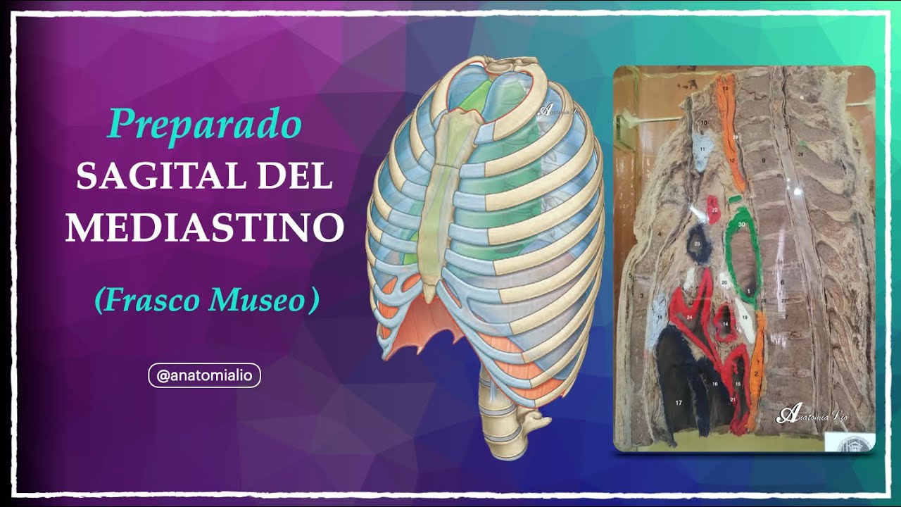 Cómo pensar un preparado de mediastino (sin memorizar de más)