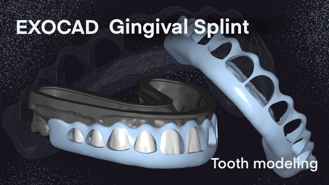 Exocad Gingival splint I Tooth Modeling 31