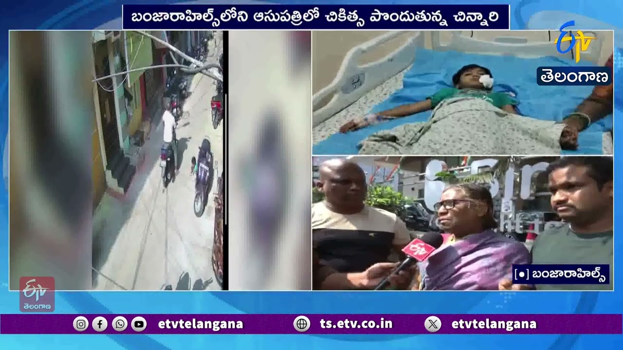 Street Dogs Attack A Girl Child at Khairatabad