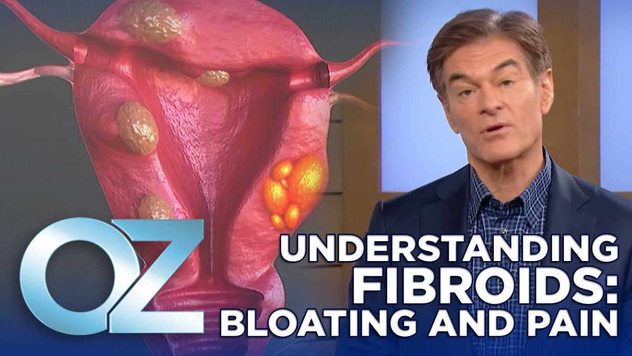 Are Your Fibroids Making You Bloated and Painful? Here's What You Need to Know | Oz Health