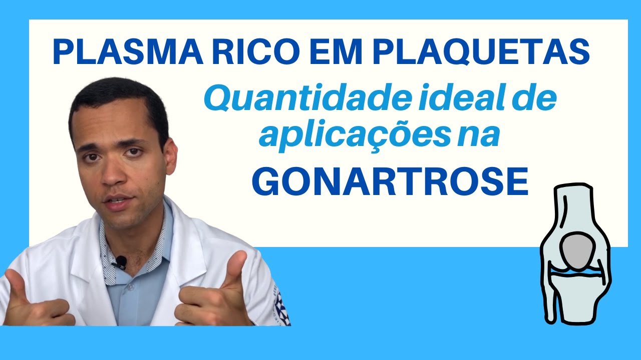 Quantidade ideal de inje&ccedil;&otilde;es de PRP para gonartrose