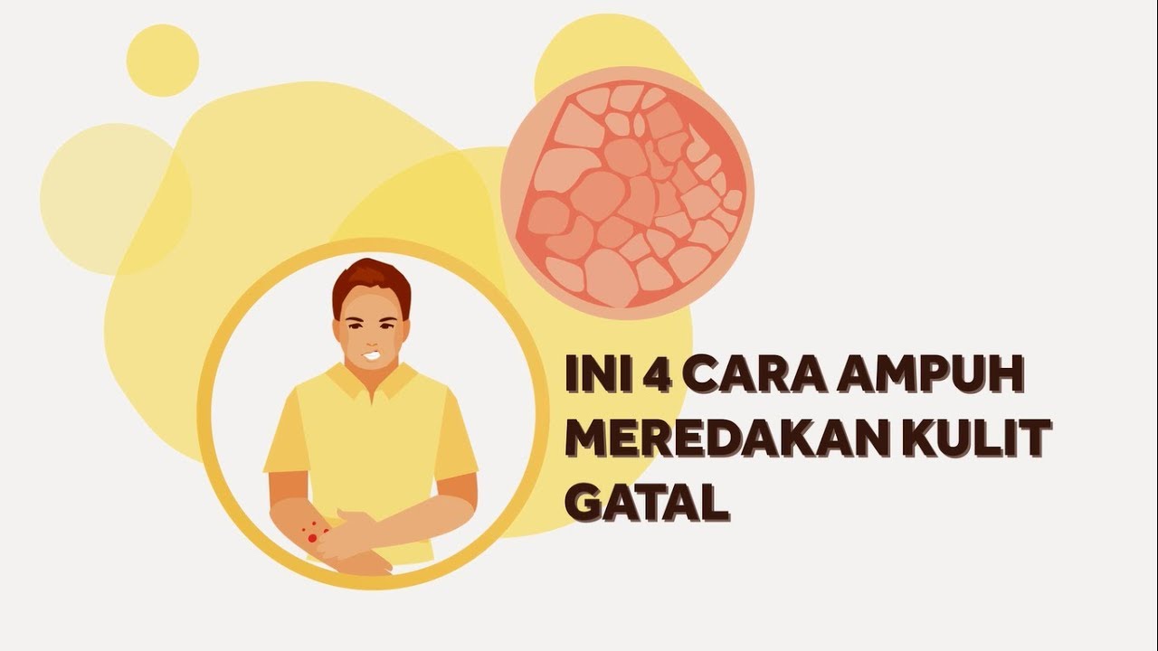 4 Cara Ampuh Meredakan Kulit Gatal